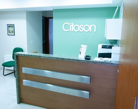 Recepção da Citoson