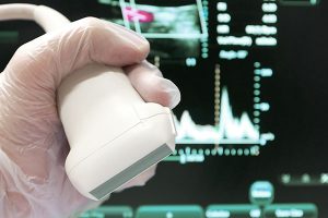 Ecografia Doppler - Cervical, Hipocôndrio, Obstétrica, Próstata, Pélvica, Transvagina, Tireoide, Bolsa Escrotal