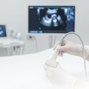ECOGRAFIA TRANSVAGINAL PARA CONTROLE DE ENDOMETRIOSE